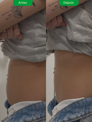 antes-e-depois-5