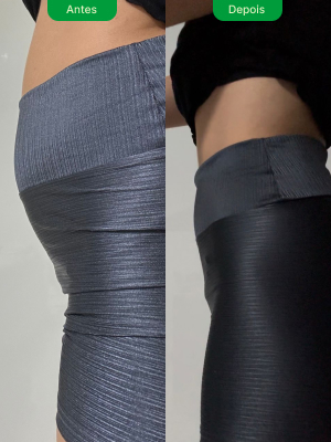 antes-e-depois-6