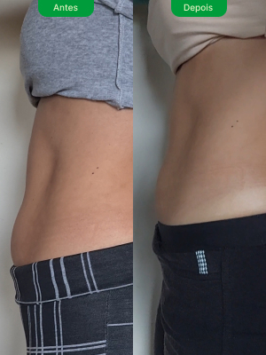 antes-e-depois-7