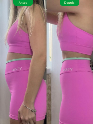 antes-e-depois-8